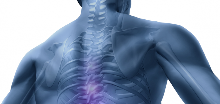 Scoliosis and Numbness
