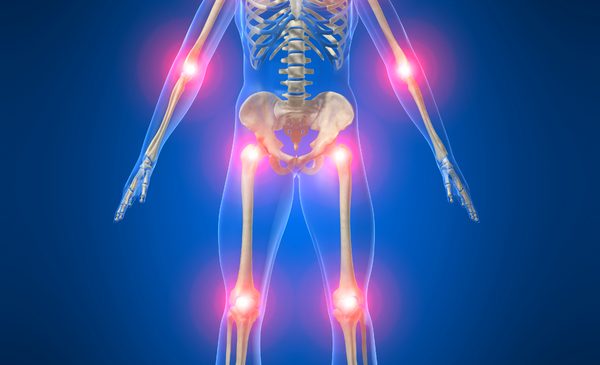 Severe Bone & Joint Pain – Central Sensitivity